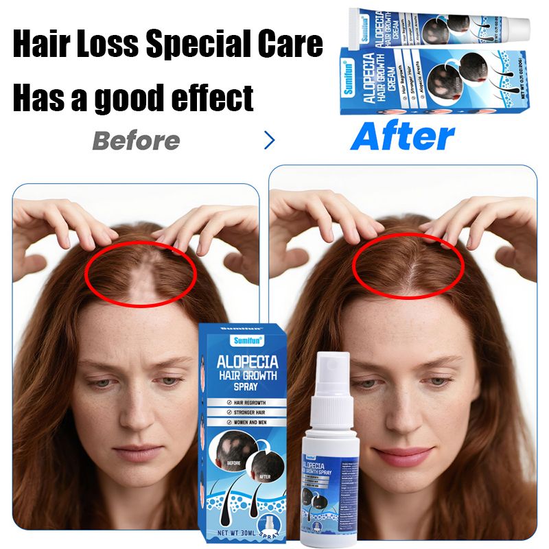 Sumifun Hair Growth Cream – Anti Hair Loss & Regrowth Cream for Men & Women