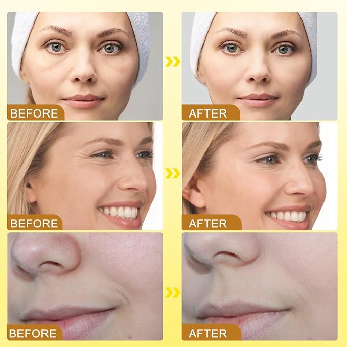 BOTO-X Bee Venom Face Cream – Anti-Aging Wrinkle Care, Firming & Lifting Moisturizer for Smooth, Youthful-Looking Skin